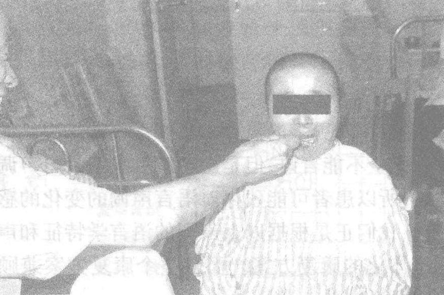 重度癡呆的臨床治療、康復(fù)、護(hù)理——以人文精神、人道主義善待患者